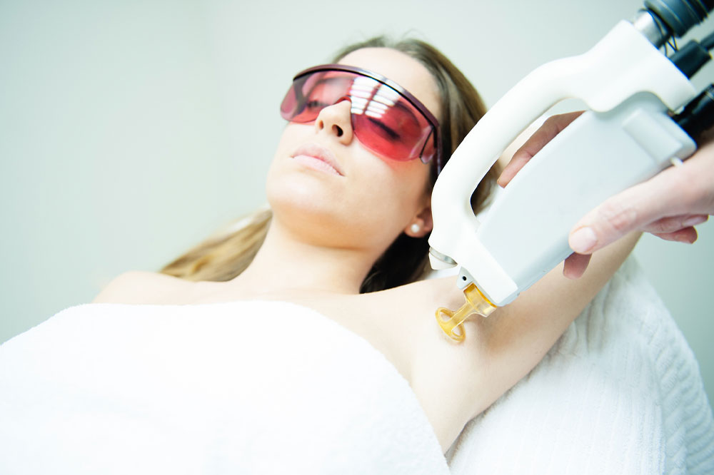 9 Reasons Laser Hair Removal is a Great Choice