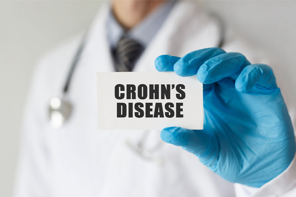 17 Interesting Facts to Know About Crohn’s