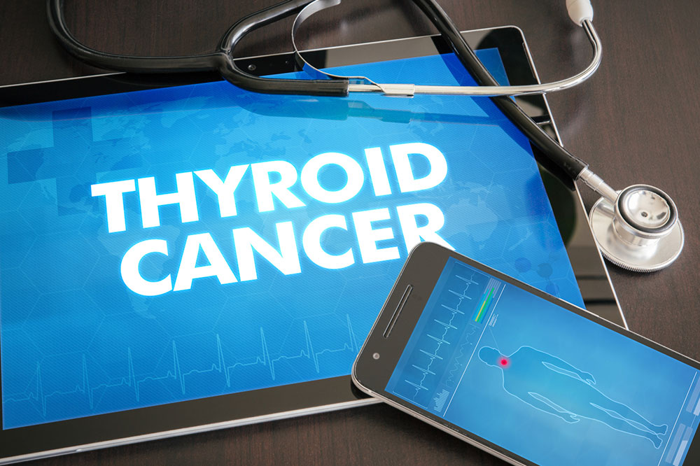 Thyroid Cancer – Causes, Symptoms, Diagnostic Options, and More