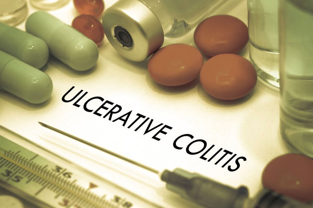 Ulcerative Colitis – Causes and Management
