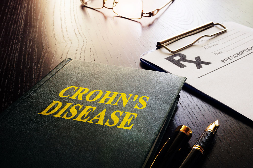 Crohn’s Disease – Types, Causes, Symptoms, and Management