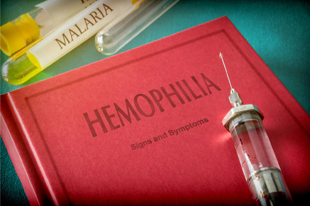 Hemophilia – Diagnosis, Symptoms, and Management