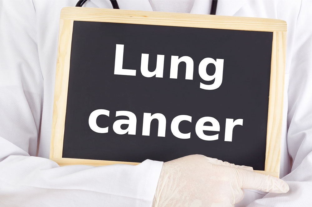 Lung Cancer Symptoms, Causes, and Remedies