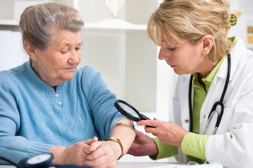 Skin Cancer – Early Signs, Types, and Preventive Tips